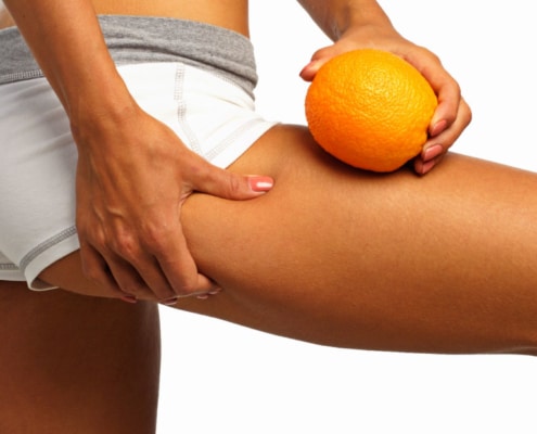 tecar e cellulite