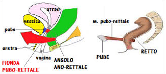 fionda pubo rettale