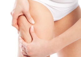 come-curare-la-cellulite-napoli-260x185 Consigli utili dal nostro Blog